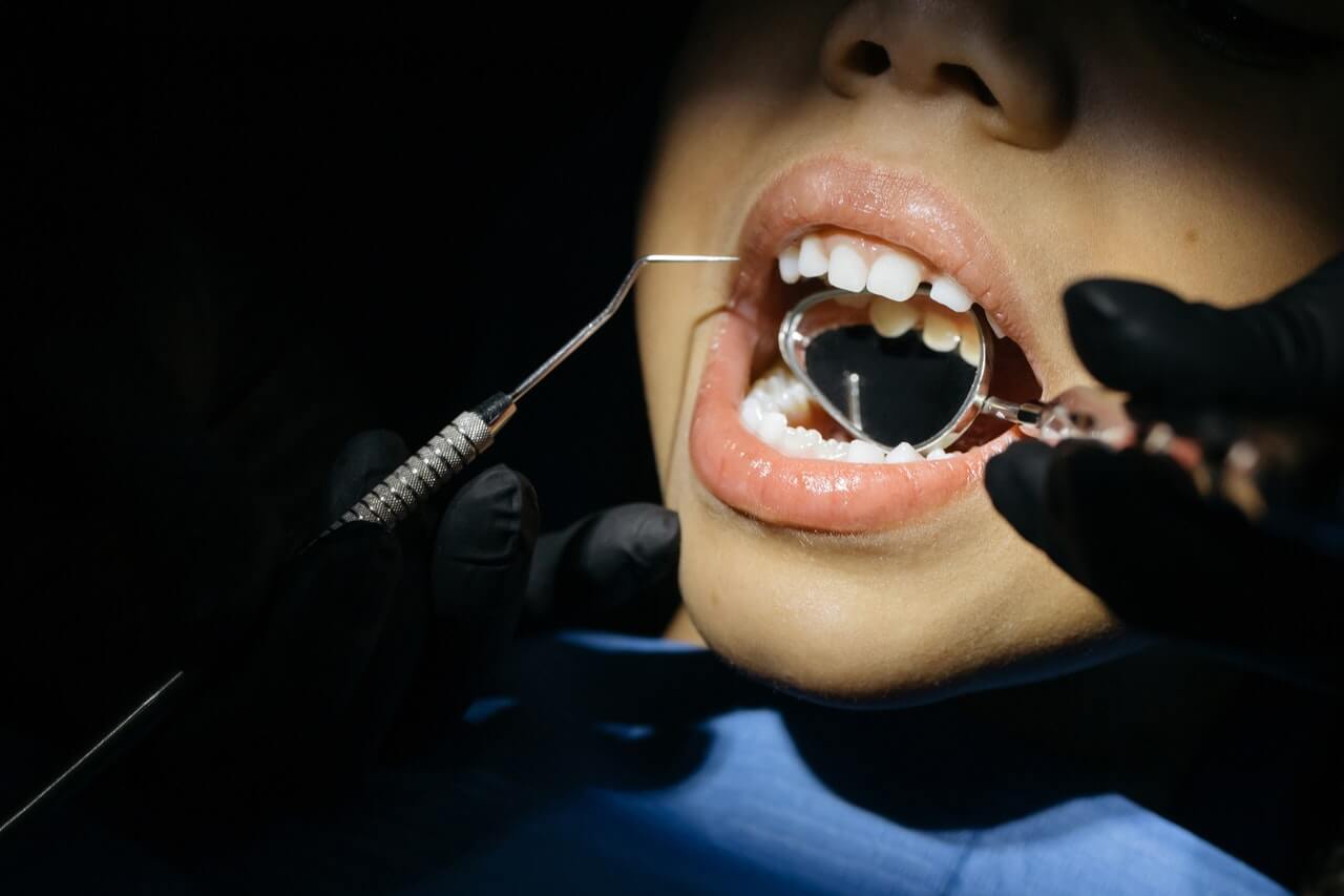 Lakierowanie zębów – co to?